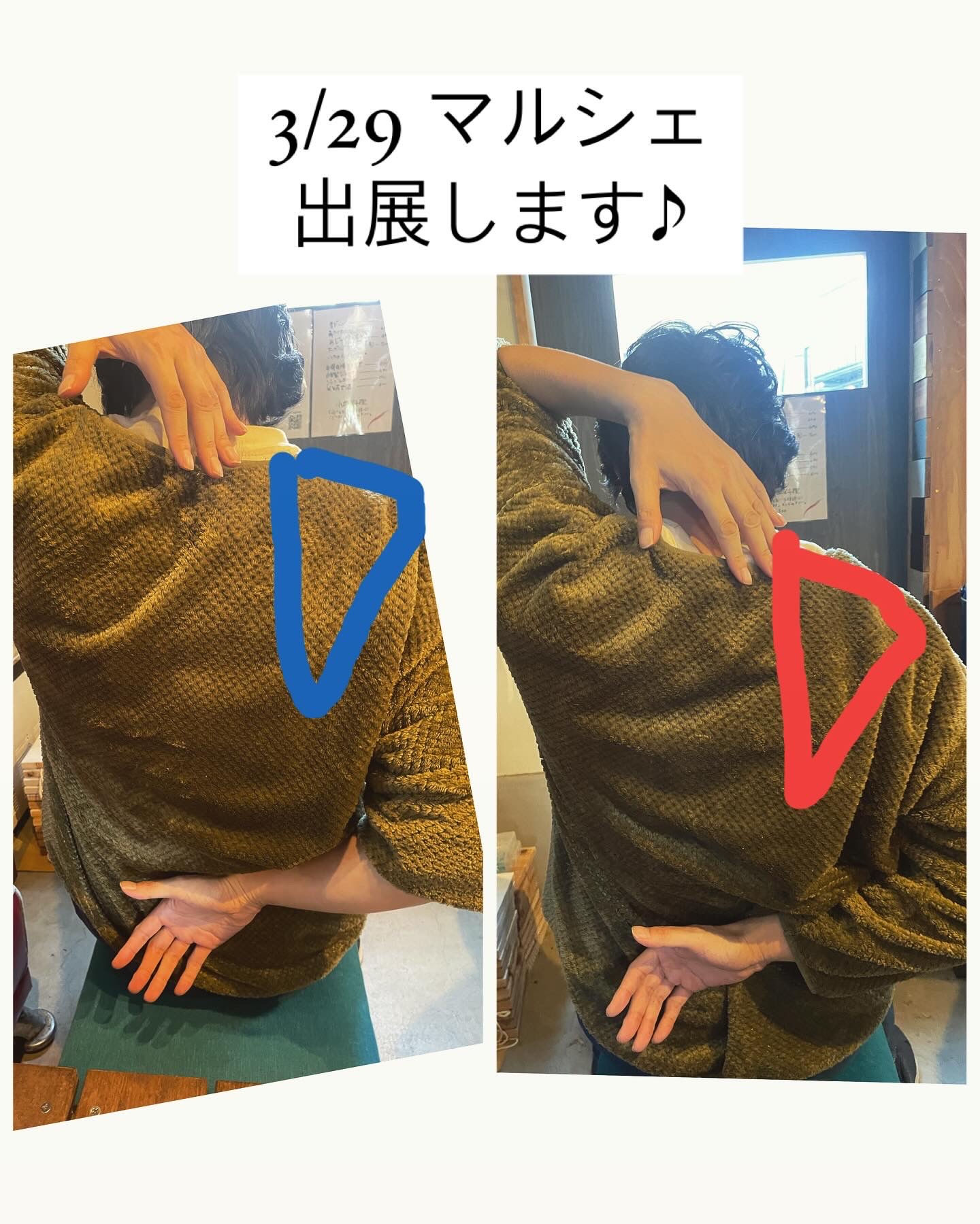 お試し施術