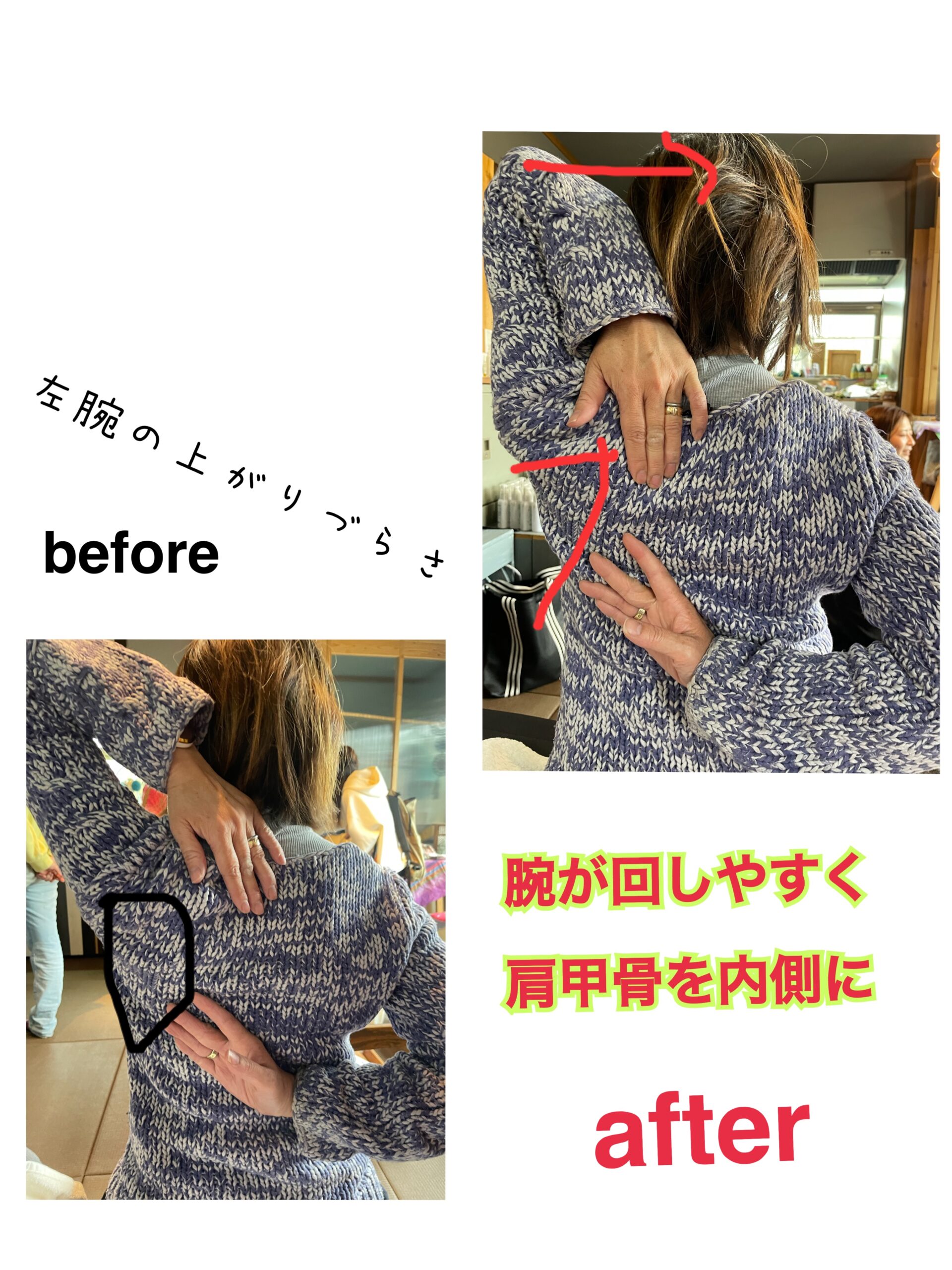 左肩の可動域を広げました！